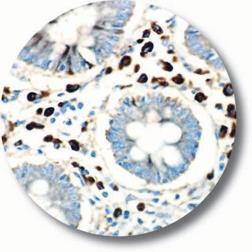 IHC of CA19-9 on an FFPE Salivary Gland Tissue